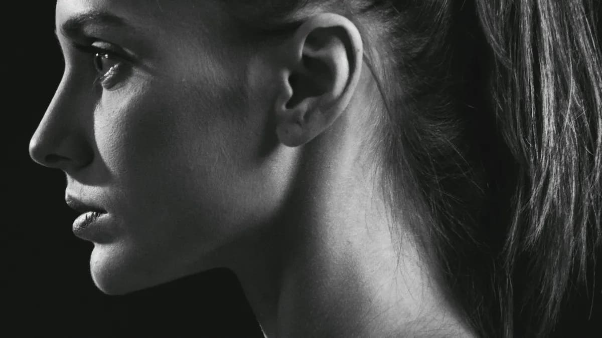 Otoplasty in adults: local anesthesia, headband and recovery